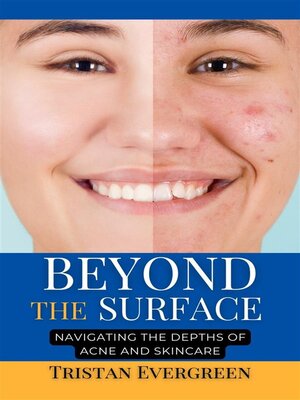 cover image of Beyond the Surface